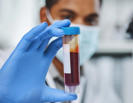 affordable Pathology services in north kolkata affordable diagnostic center Kolkata